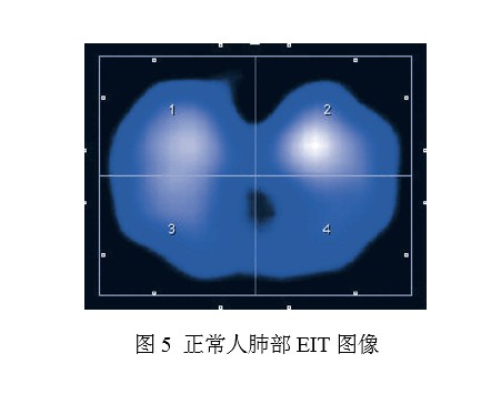 生物电阻抗断层成像