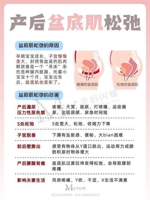 产后盆底康复