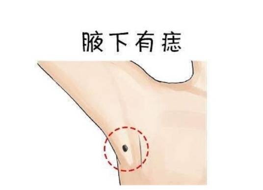 苦缘痣