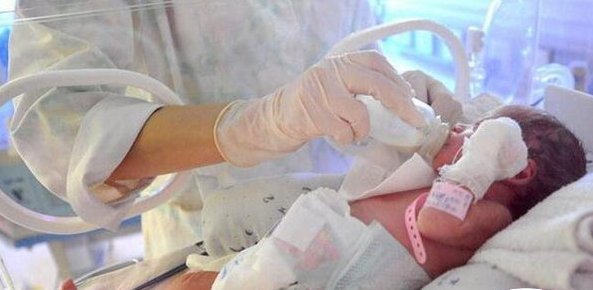 罕见！印度3周大女婴肚子里取出8个寄生胎，女婴的现状如何？