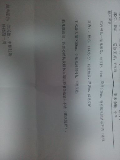 脐点1988的介绍