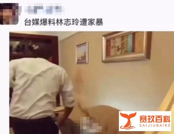 林志玲遭日本老公家暴！假体都被打掉，现回台湾修复