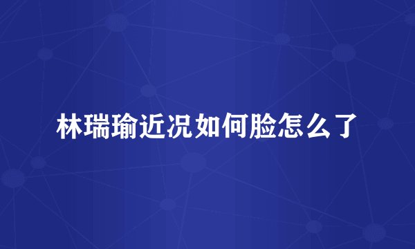 林瑞瑜近况如何脸怎么了