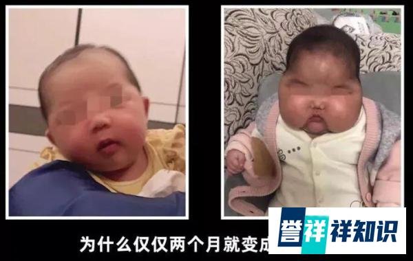 5个月女婴成“大头娃娃”，疑因抹了婴儿霜，厂商和卫健部门回应了