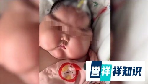 5个月女婴成“大头娃娃”，疑因抹了婴儿霜，厂商和卫健部门回应了