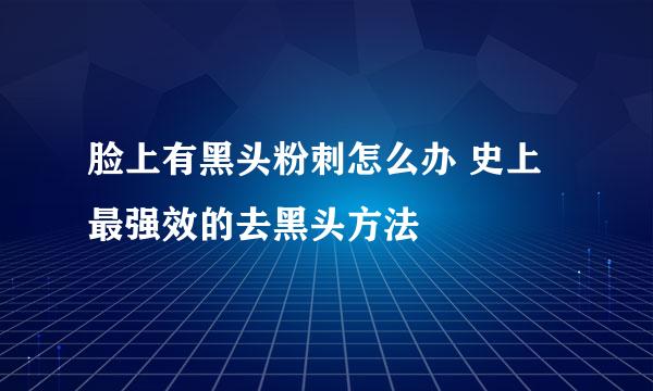 脸上有黑头粉刺怎么办 史上最强效的去黑头方法