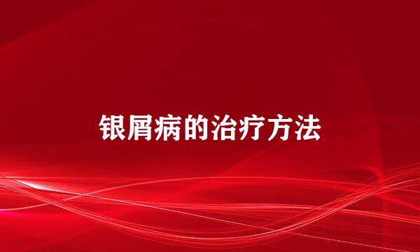 银屑病的治疗方法