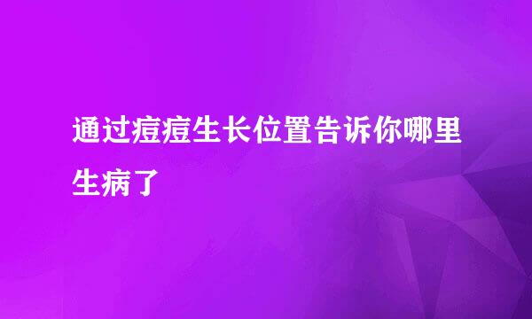 通过痘痘生长位置告诉你哪里生病了