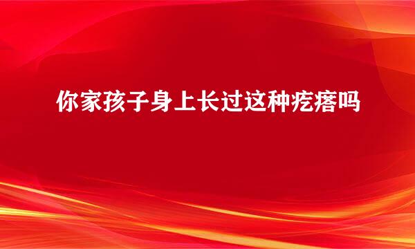 你家孩子身上长过这种疙瘩吗