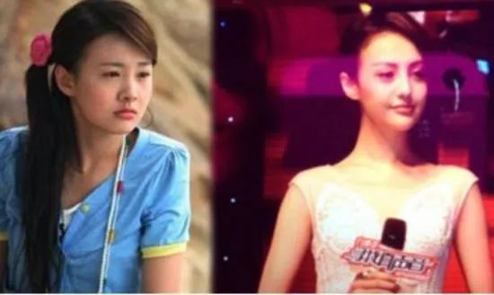 你们觉得郑爽整容前漂亮还是整容后漂亮?