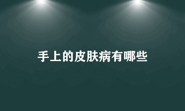 手上的皮肤病有哪些