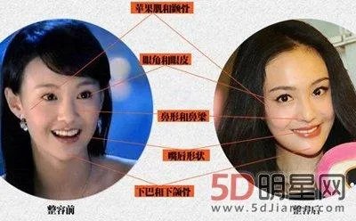 你们觉得郑爽整容前漂亮还是整容后漂亮?