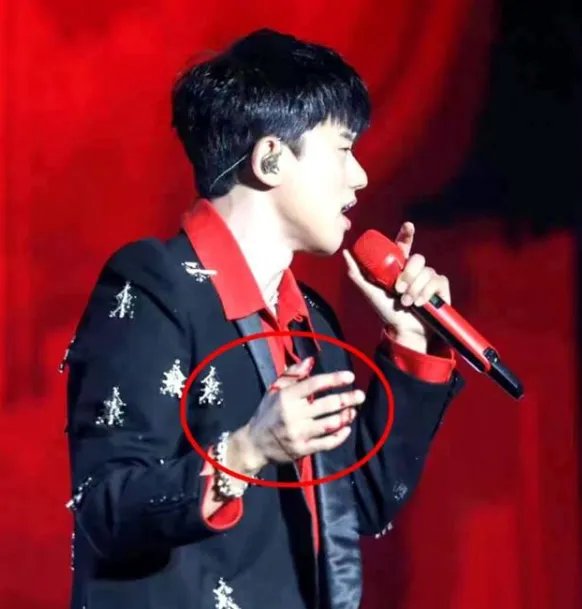 张杰在演唱会摔伤后首次亮相，他的状态如何？