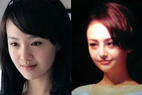 你们觉得郑爽整容前漂亮还是整容后漂亮?