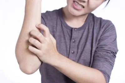 孕妇皮肤过敏对胎儿有影响