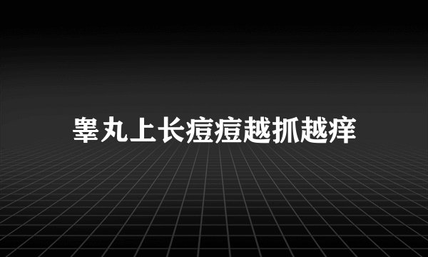 睾丸上长痘痘越抓越痒