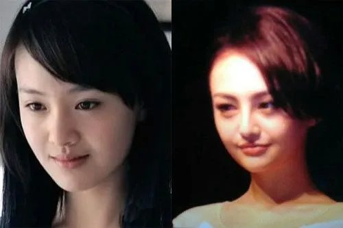你们觉得郑爽整容前漂亮还是整容后漂亮?