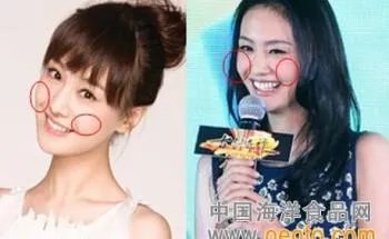 你们觉得郑爽整容前漂亮还是整容后漂亮?