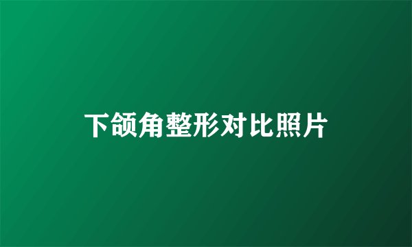下颌角整形对比照片