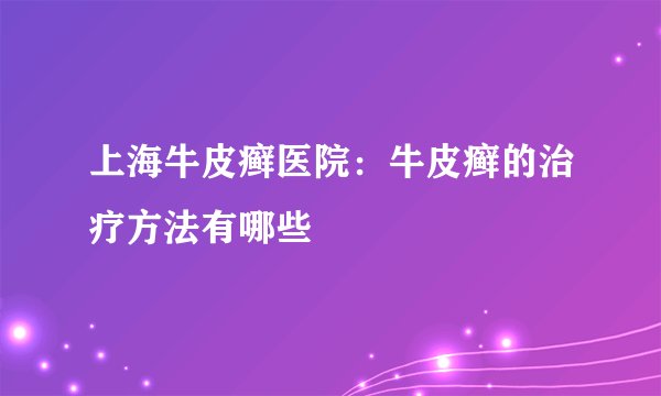 上海牛皮癣医院：牛皮癣的治疗方法有哪些