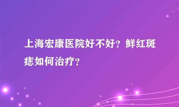 上海宏康医院好不好?鲜红斑痣如何治疗?