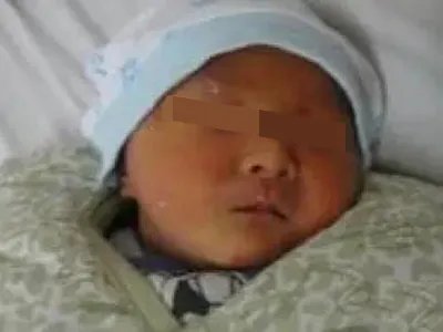 维生素E缺乏症皮肤发黄图片