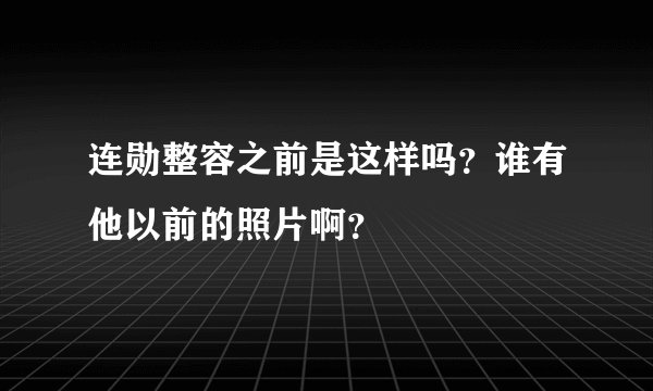 连勋整容之前是这样吗？谁有他以前的照片啊？