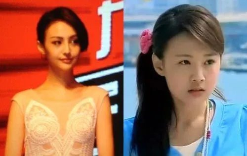 你们觉得郑爽整容前漂亮还是整容后漂亮?