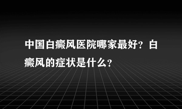 中国白癜风医院哪家最好?白癜风的症状是什么?