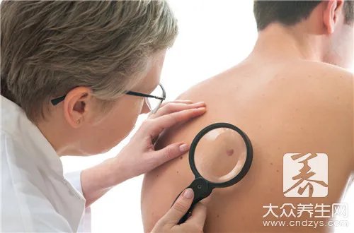  身上长痣面相图解大全