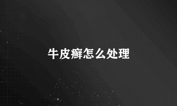 牛皮癣怎么处理
