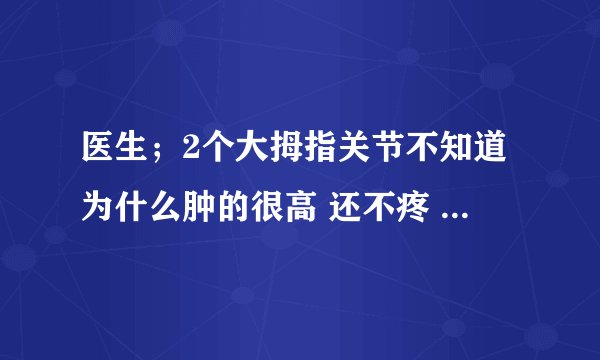 医生;2个大拇指关节不知道为什么肿的很高 还不疼 这是...