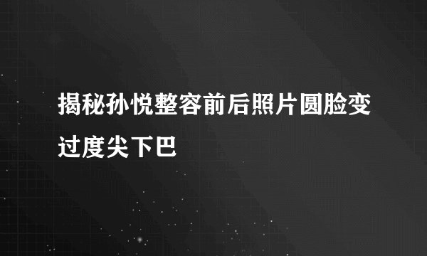 揭秘孙悦整容前后照片圆脸变过度尖下巴