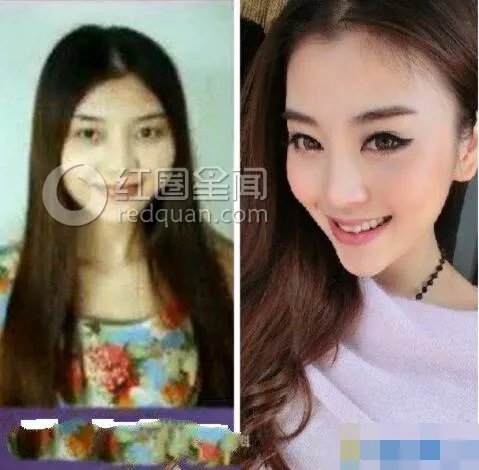龚美琪整容前后对比照 龚美琪结婚对象是谁