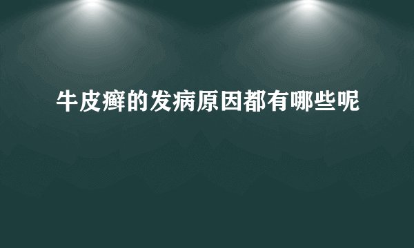 牛皮癣的发病原因都有哪些呢