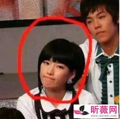 潘南奎以前的样子:潘南奎整容后的美照欣赏