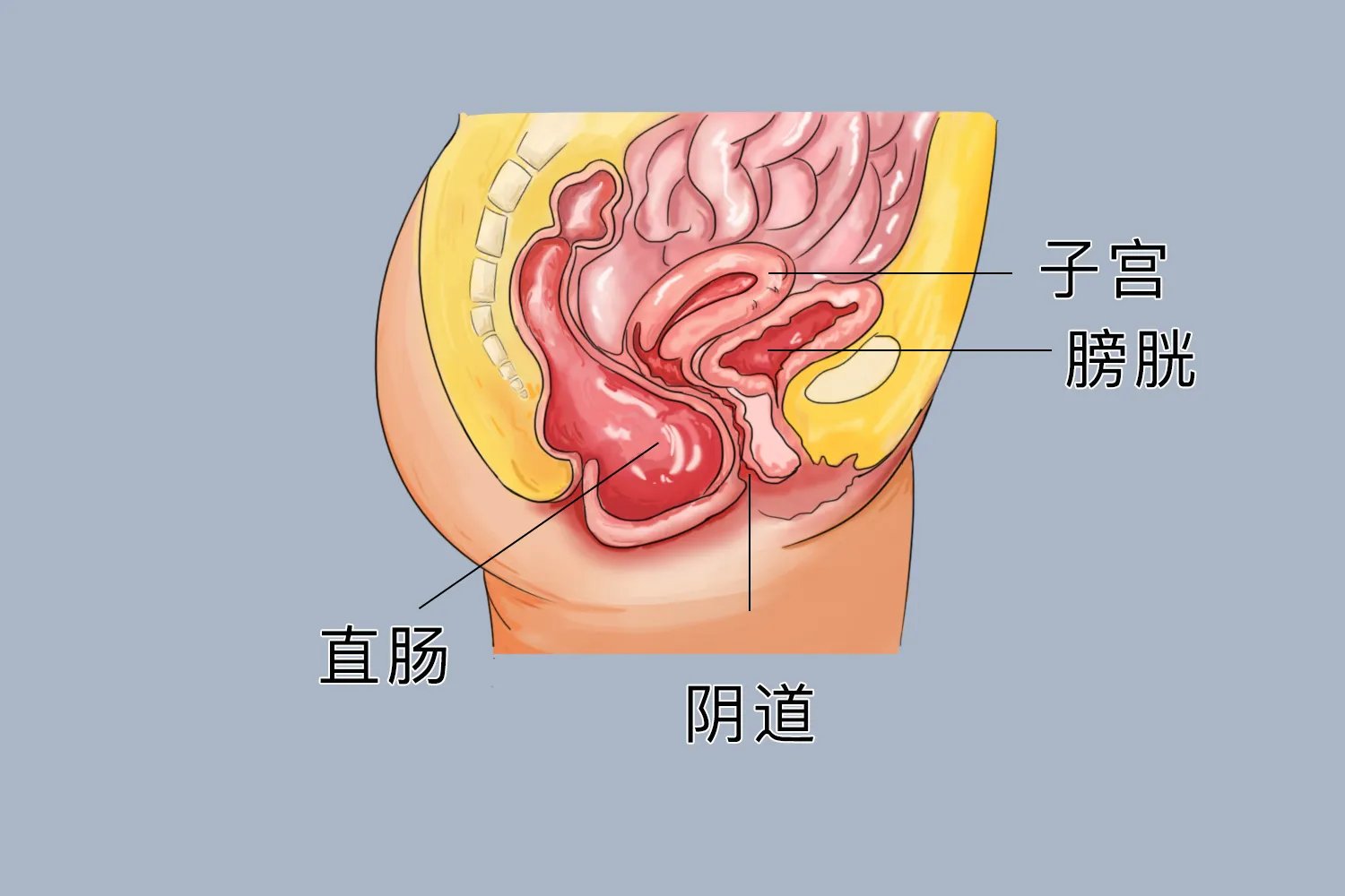 顺产后阴壁膨出症状图