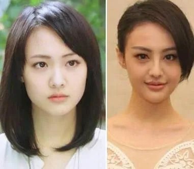 你们觉得郑爽整容前漂亮还是整容后漂亮?