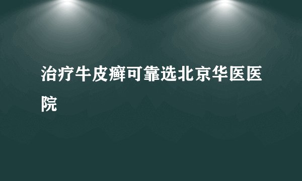 治疗牛皮癣可靠选北京华医医院