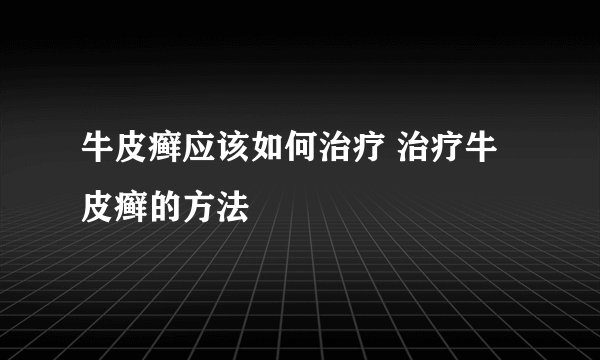 牛皮癣应该如何治疗 治疗牛皮癣的方法