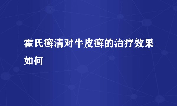 霍氏癣清对牛皮癣的治疗效果如何