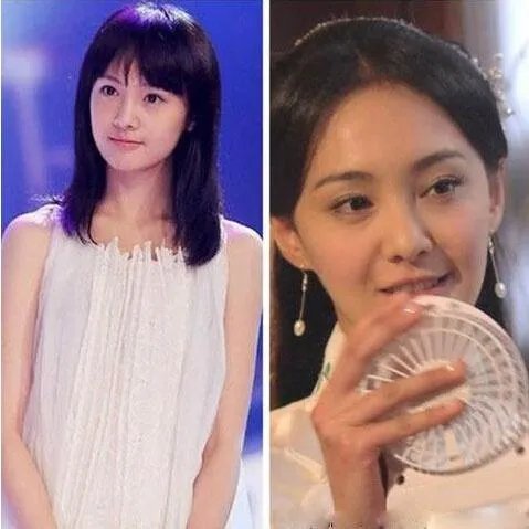 你们觉得郑爽整容前漂亮还是整容后漂亮?