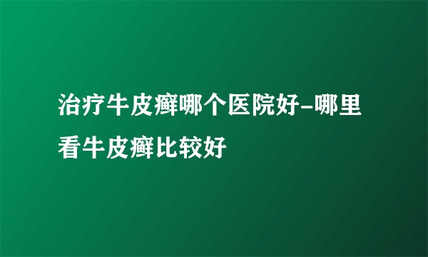 治疗牛皮癣哪个医院好-哪里看牛皮癣比较好