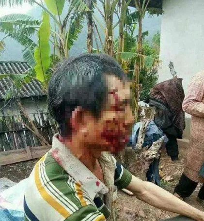 云南一老人四年两次被熊袭击是怎么回事?