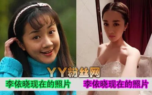 李依晓个人资料：李依晓整容前后照片对比（图）