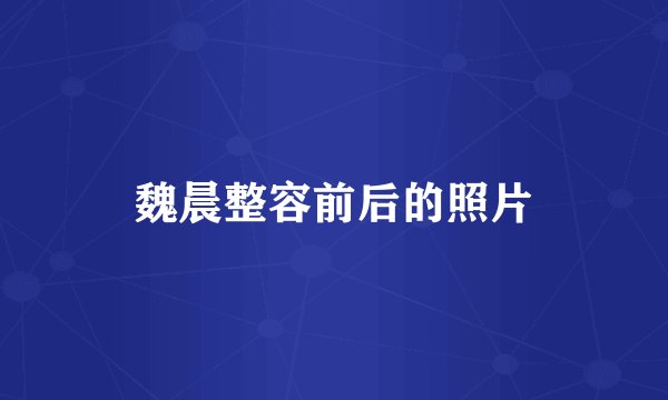 魏晨整容前后的照片