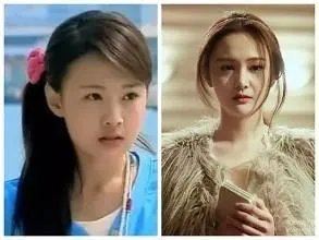 你们觉得郑爽整容前漂亮还是整容后漂亮?