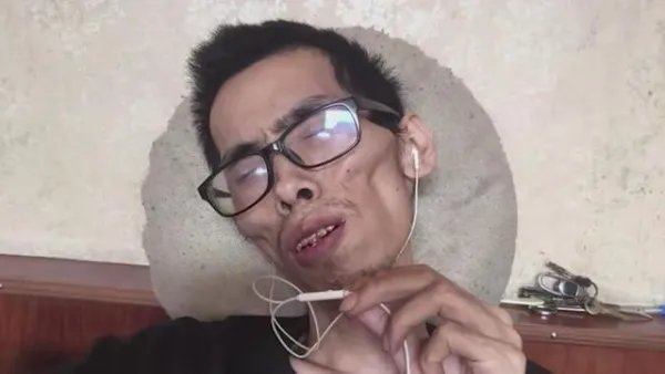 抗癌小伙阿健逝世,他到底经历了哪些坎坷?