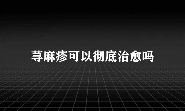 荨麻疹可以彻底治愈吗