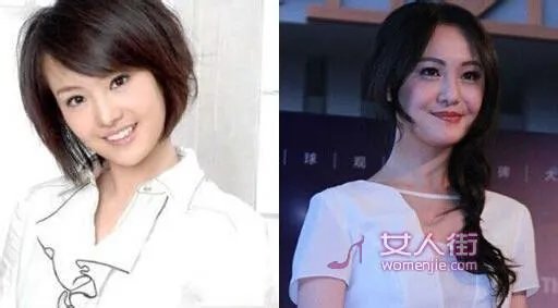 你们觉得郑爽整容前漂亮还是整容后漂亮?